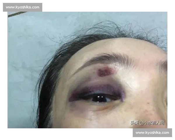 反转！张培萌沉冤 5 年：无家暴无出轨，前妻道歉赔偿 2.6 万